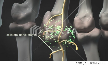 Collateral Nerve Branch 3d medical Collateral Nerve Branch 3d medical 89617668