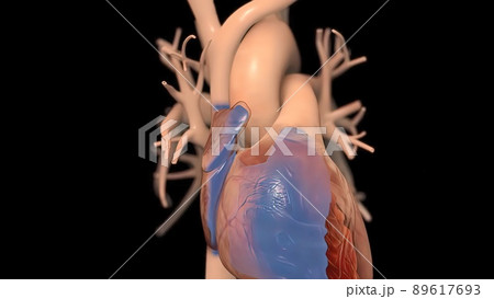 illustration Congestive Heart Failure 89617693