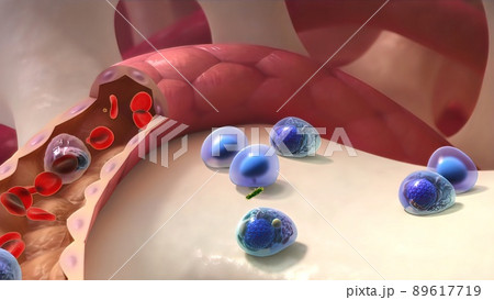 Spread of healthy cell and cancer cell 89617719