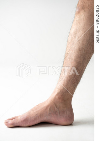 男性　ムダ毛　すね毛 89620825