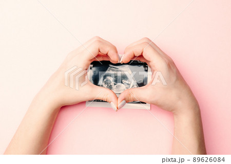 Ultrasound picture pregnant baby photo. Woman hands holding ultrasound pregnancy image on pink background. Concept of pregnancy, maternity, expectation for baby birth. 89626084