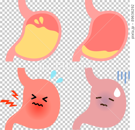 胃酸過多の胃と低胃酸の胃のキャラクター 89636292