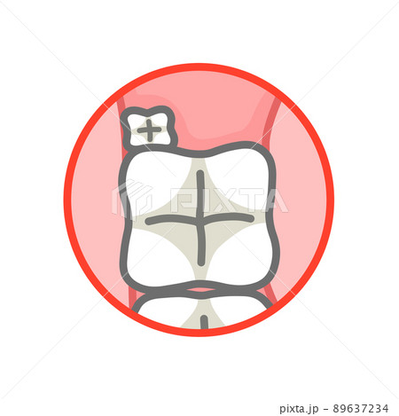 口の中の第一大臼歯と第二大臼歯と小さな第三大臼歯 口の中の第一大臼歯と第二大臼歯と小さな第三大臼歯 89637234