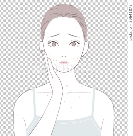 Women suffering from adult acne Women suffering from adult acne 89641878