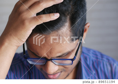 hair loss concept with man checking his hair  89651194
