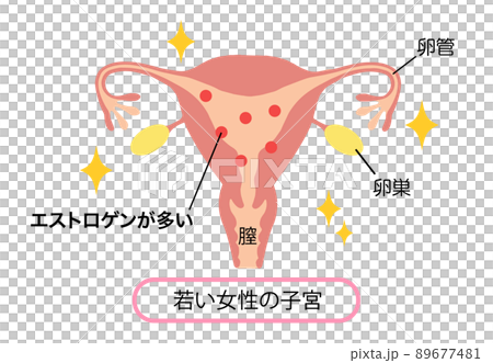 エストロゲンが多い、若い女性の子宮イラスト 89677481