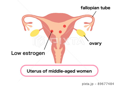 エストロゲンが少ない、中年女性の子宮イラスト 89677484