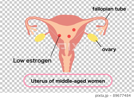 エストロゲンが少ない、中年女性の子宮イラスト 89677484