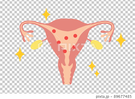 エストロゲンが多い、若い女性の子宮イラスト 89677485