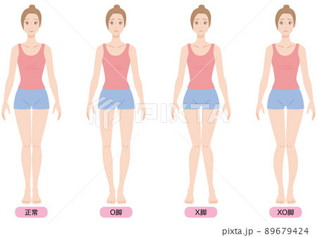 O脚・X脚・XO脚の女性 89679424