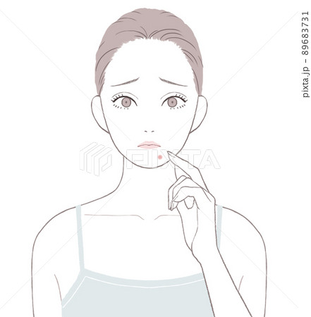 あごニキビに悩む女性 89683731