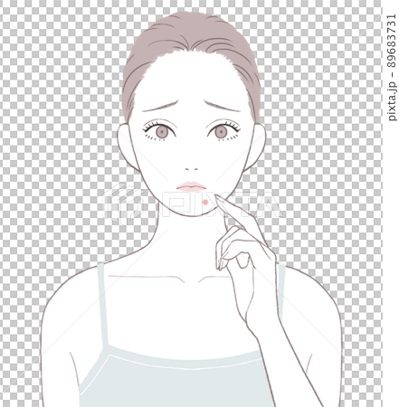 あごニキビに悩む女性 89683731