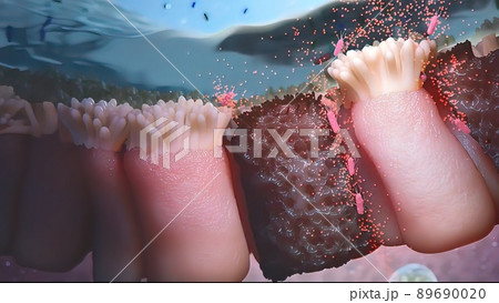 Bacteria attack the digestive system Bacteria attack the digestive system 89690020