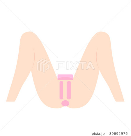 VIO脱毛。デリケートゾーンの脱毛部位の図解。 89692976