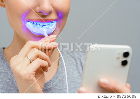 A woman holds in his hand an ultraviolet lamp for home teeth whitening. A snow-white smile after bleaching. 89726688