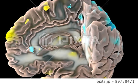 Human brain with neuronal impulses. Spinning. Loopable Human brain with neuronal impulses. Spinning. Loopable 89758471