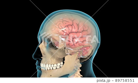 Cerebrospinal fluid (CSF) is a clear fluid that surrounds the brain and spinal cord Cerebrospinal fluid (CSF) is a clear fluid that surrounds the brain and spinal cord 89758551