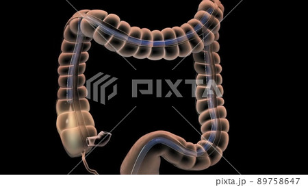 The Human Digestive System. 3D illustration of the colonoscopy Procedure 89758647