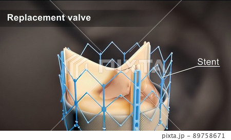 Cardiac catheterization is a procedure used to diagnose and treat certain cardiovascular conditions 89758671