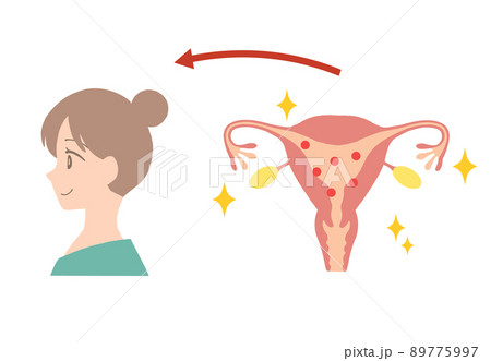 エストロゲンが多い、若い女性の子宮イラスト 89775997