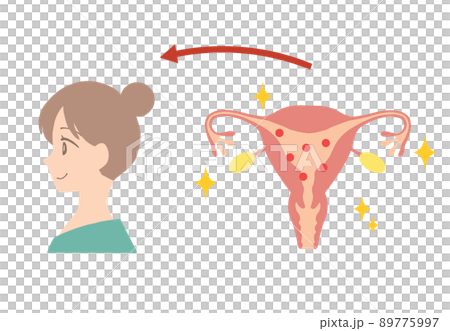 エストロゲンが多い、若い女性の子宮イラスト 89775997