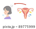 エストロゲンが少ない、更年期障害の中年女性の子宮イラスト 89775999