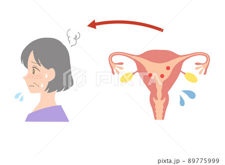 エストロゲンが少ない、更年期障害の中年女性の子宮イラスト 89775999
