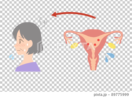 エストロゲンが少ない、更年期障害の中年女性の子宮イラスト 89775999