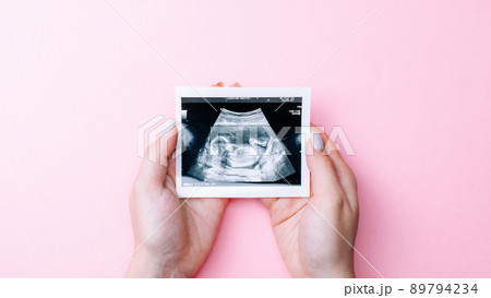 Ultrasound picture pregnant baby photo. Woman hands holding ultrasound pregnancy image on pink background. Concept of pregnancy, maternity, expectation for baby birth. 89794234