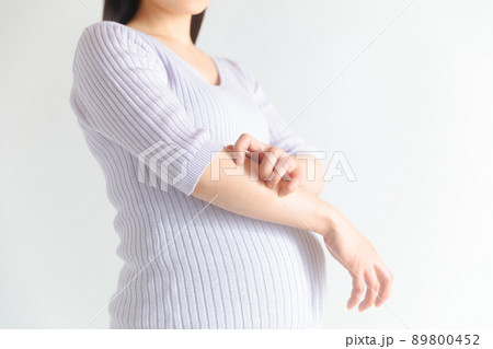 爪を立てて腕を掻く妊婦 爪を立てて腕を掻く妊婦 89800452