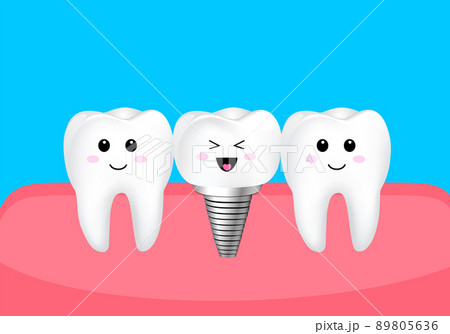 Cartoon tooth character with dental implant. Cartoon tooth character with dental implant. 89805636