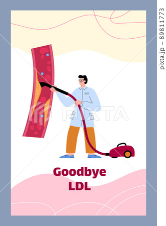 Doctor with vacuum cleaner cleaning LDL or bad cholesterol from artery, poster template, flat vector illustration. Doctor with vacuum cleaner cleaning LDL or bad cholesterol from artery, poster template, flat vector illustration. 89811773