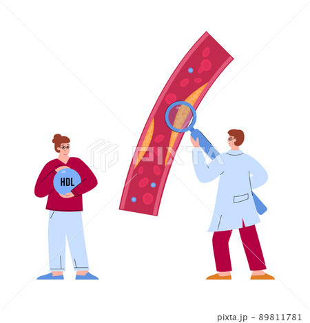 Doctor looking at cholesterol in artery with magnifying glass, flat vector illustration isolated on white background. 89811781