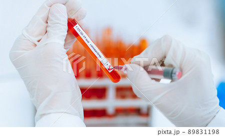 scientist puts a check mark on the tube with the test. 89831198