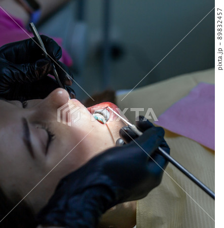 A woman at a dentist's appointment to replace arches with braces 89832457