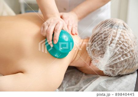 Vacuum massage. Vacuum cups of medical cupping therapy on woman back, close up, chinese medicine. 89840445