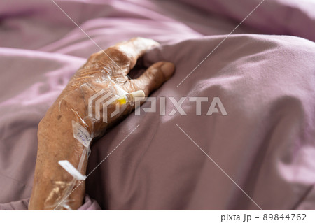 Normal Saline Solution or NSS plug socket for injector is plugged in on the hand of old patient close up with copyspace. Medication service and healthcare in elder people. 89844762