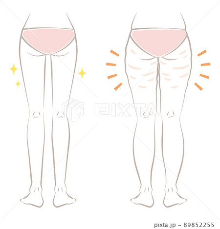 下半身太りの女性 89852255