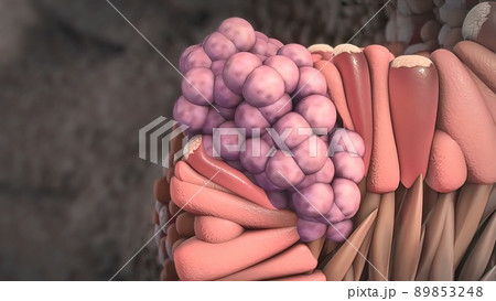 Division and growth of cancerous cells 89853248