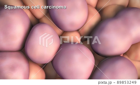 Division and growth of cancerous cells Division and growth of cancerous cells 89853249