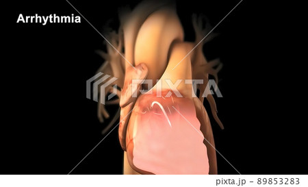 Cardiac Conduction System 3d medical Cardiac Conduction System 3d medical 89853283
