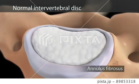 Top view of normal intervertebral disc Top view of normal intervertebral disc 89853318