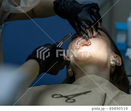 A woman at a dentist's appointment to replace arches with braces 89890519