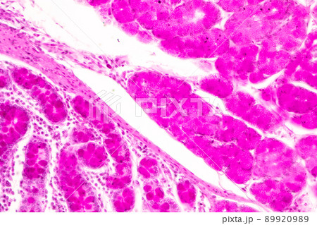 Tissue of Small intestine (Duodenum) and Vermiform appendix  Human under the microscope in Lab. 89920989
