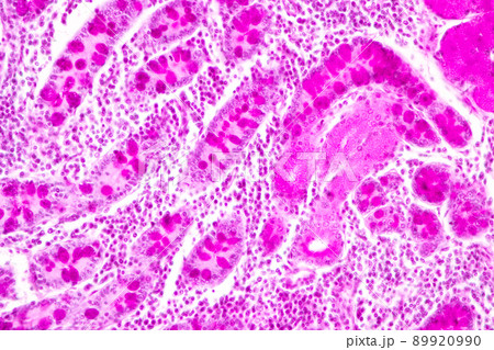 Tissue of Small intestine (Duodenum) and Vermiform appendix  Human under the microscope in Lab. 89920990