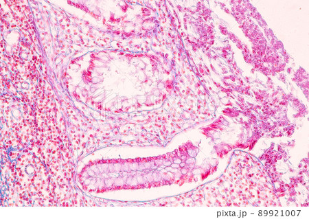 Tissue of Small intestine (Duodenum) and Vermiform appendix Human under the microscope in Lab. Tissue of Small intestine (Duodenum) and Vermiform appendix Human under the microscope in Lab. 89921007