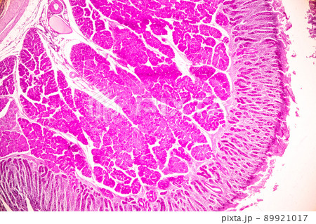 Tissue of Small intestine (Duodenum) and Vermiform appendix Human under the microscope in Lab. Tissue of Small intestine (Duodenum) and Vermiform appendix Human under the microscope in Lab. 89921017
