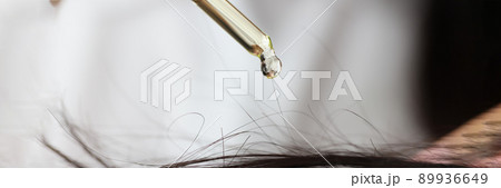Oil from a pipette drips onto the hair on the head 89936649