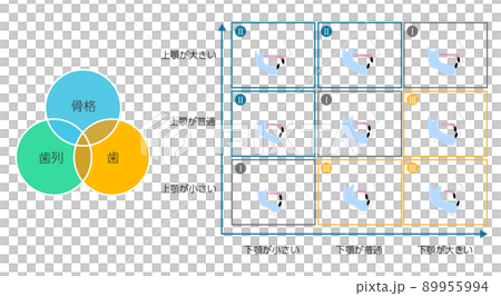 顎の骨格と噛み合わせ・不正咬合の歯科矯正 89955994