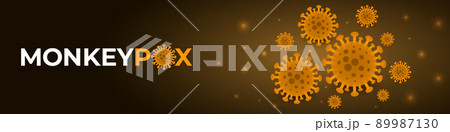 Monkeypox virus cells outbreak wide medical...のイラスト素材 [89987130] - PIXTA